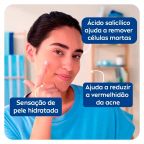  Hidratante Facial Nivea Acne Control 50ml – miniatura 4