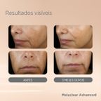 Sérum Facial Clareador Isdin Isdinceutics Melaclear Advanced 30ml – miniatura 9