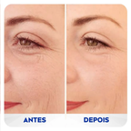 Creme Facial Preenchedor de Rugas Nivea Q10 Antissinais Expert 15ml – miniatura 4
