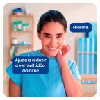 Tônico Facial Nivea Acne Control 200ml – miniatura 5